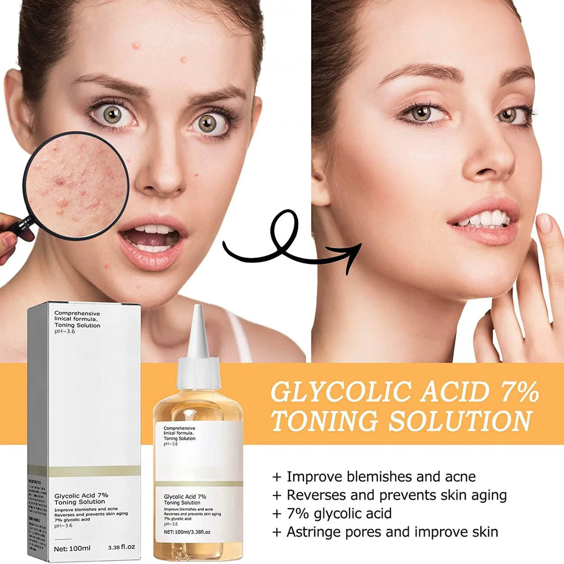 Glycolic Acid 7% Exfoliating Toning Solution – Acne & Skin Renewal
