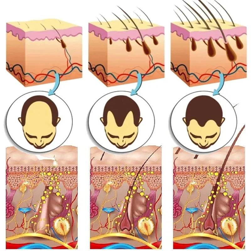 7 Days Ginger Hair Growth Serum – Anti Hair Loss